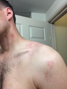 Some of the wounds I suffered.